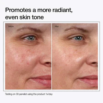 Buy 1 Get 1 Free Urapra Glycolic Acid 7% Toning Solution