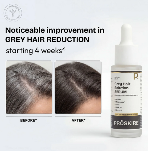 (BUY ONE GET ONE FREE)Anti Grey Serum-Restore your natural hair color with every drop